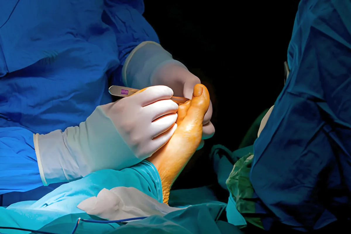 Surgery