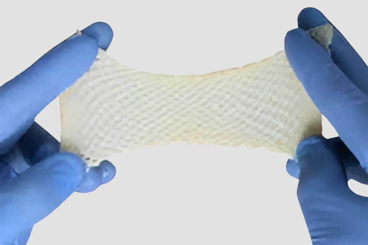 Acellular Dermal Grafts