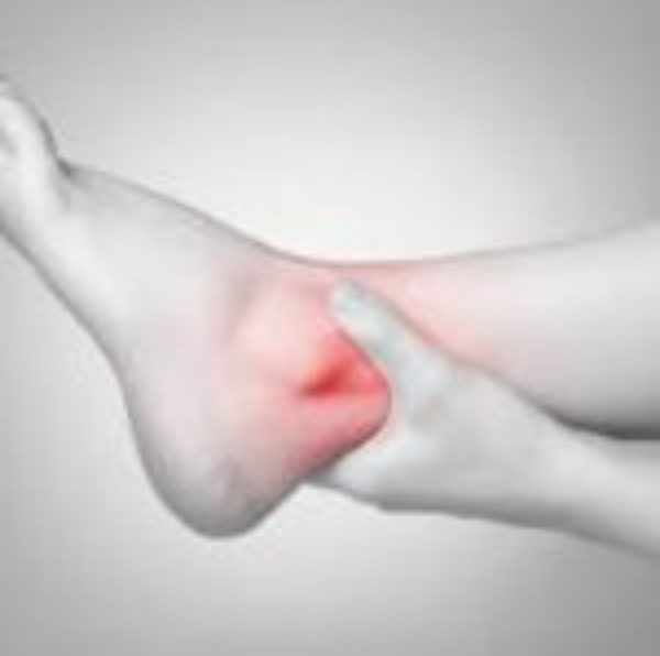 Ankle Sprains - Management & Prevention